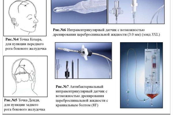 Ссылка на кракен супернет